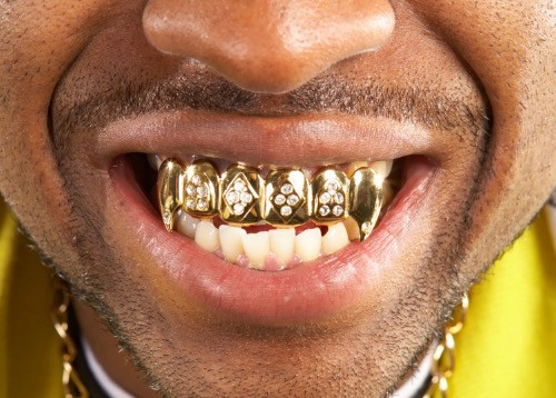 Cash in on your gold. How to sell jewellery, teeth and trinkets for top prices